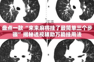 盘点一款“来来麻将挂了最简单三个步骤”揭秘透视辅助万能挂用法