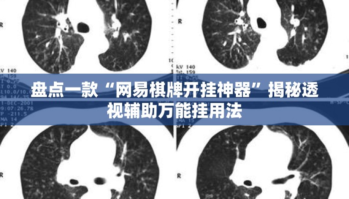 盘点一款“网易棋牌开挂神器”揭秘透视辅助万能挂用法
