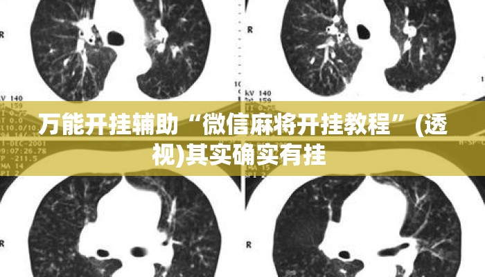 万能开挂辅助“微信麻将开挂教程”(透视)其实确实有挂 