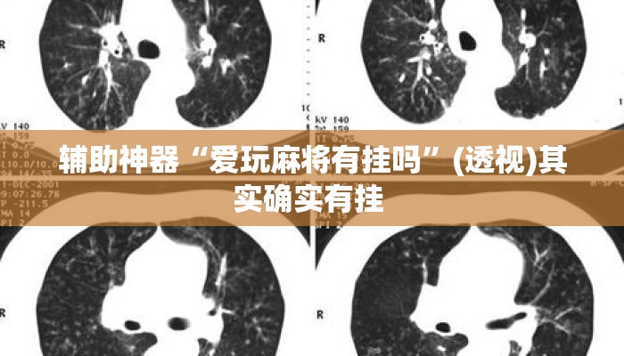 辅助神器“爱玩麻将有挂吗”(透视)其实确实有挂 